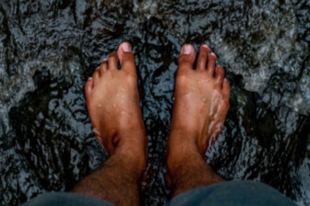 Types of Foot Deformities
