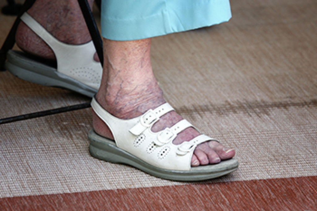 How Your Feet Change With Age