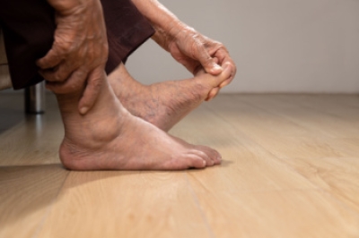 The Difference Between Gout and Pseudogout