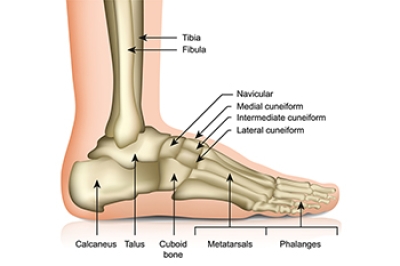 Understanding Cuboid Syndrome